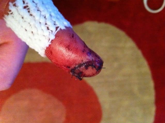 Finger