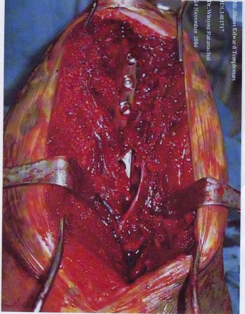 xrays0002.jpg