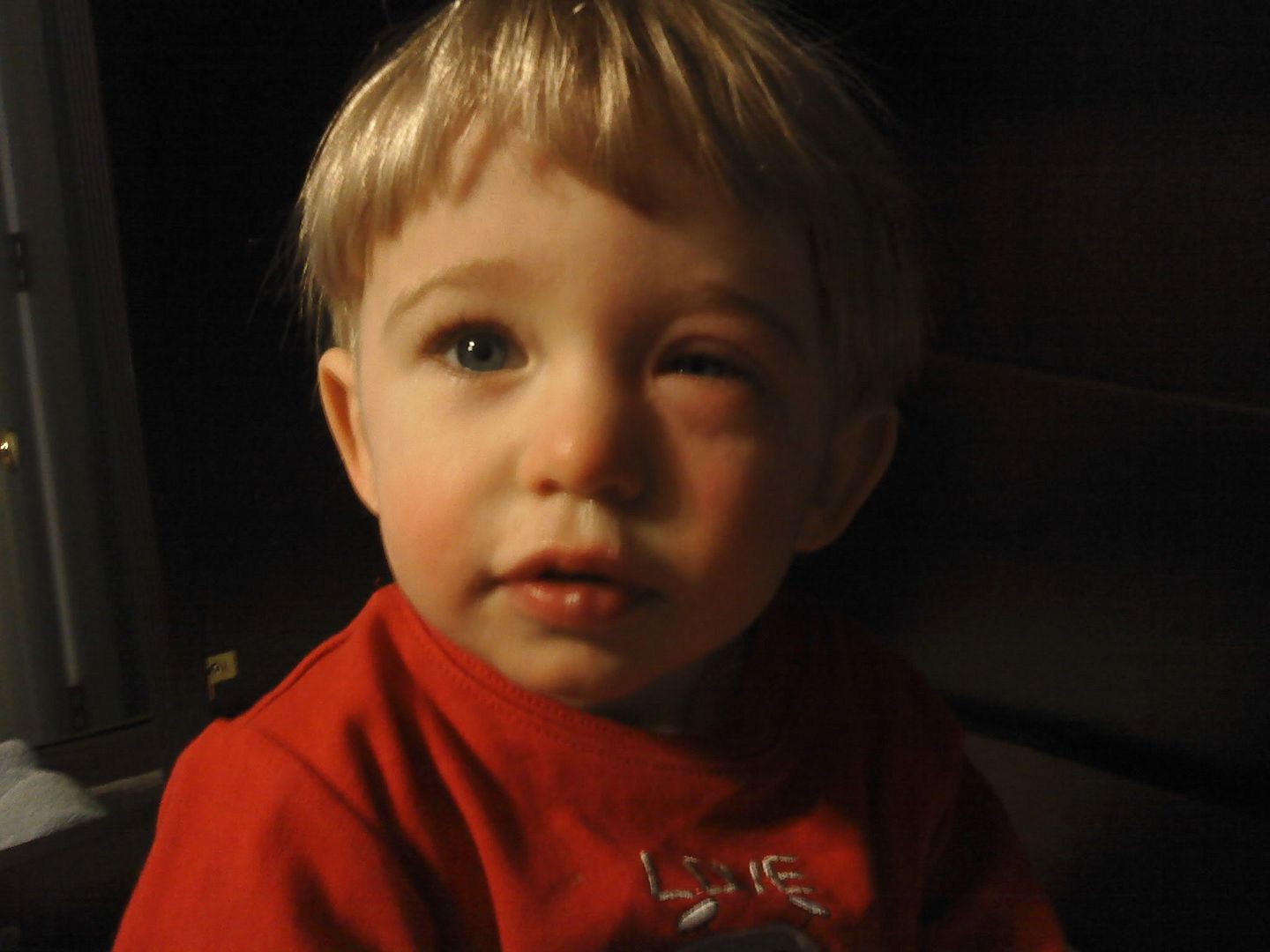 allergic to saliva children with allergy babycenter allergic to saliva children with allergy babycenter