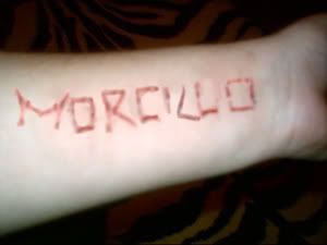 morcillobrazo.jpg